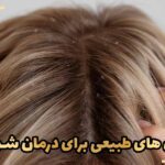 راه حل های طبیعی برای درمان شوره سر