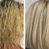 هونما بوتاکس مو1000 میلی Botox Honma