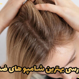 نقد و بررسی بهترین شامپو های ضد شوره