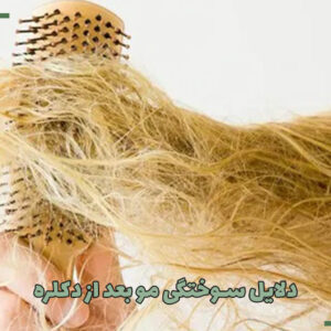 ۵ علت سوختگی مو بعد از دکلره
