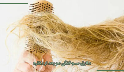 ۵ علت سوختگی مو بعد از دکلره